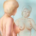 1-breast-self-exam1-bacsinoitru-vn-1402193825497-crop1402193954145p-crop1402193961281p